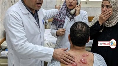 وجدتُ ثلاثين بقعة حمراء على ظهر زوجي تشبه بيض الحشرات