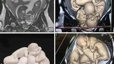 قصة الشاب والطبيب