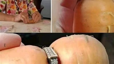 الجزرة والخاتم