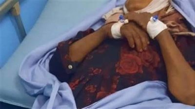 خالتي اتحـللت وعـفنت وهي عايشة والسبب خـطير