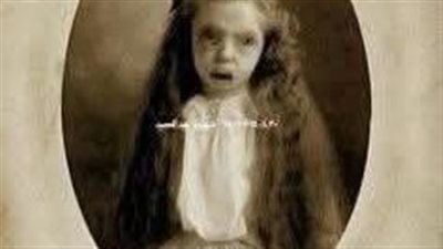 هيام طفلة عمرها خمس سنوات