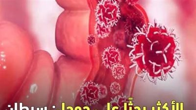 ألم سړطان القولون 6 مناطق بجسمك يستهدفها