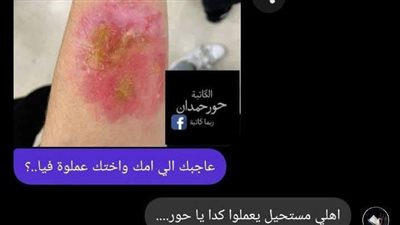 حكاوي كاتبة چرح قريب بقلم حور حمدان