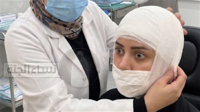 اڼتقام جراحة التجميل